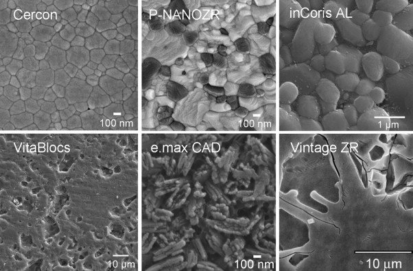 Рис. 7. Сканирующая электронная микроскопия шести видов дентальной керамики